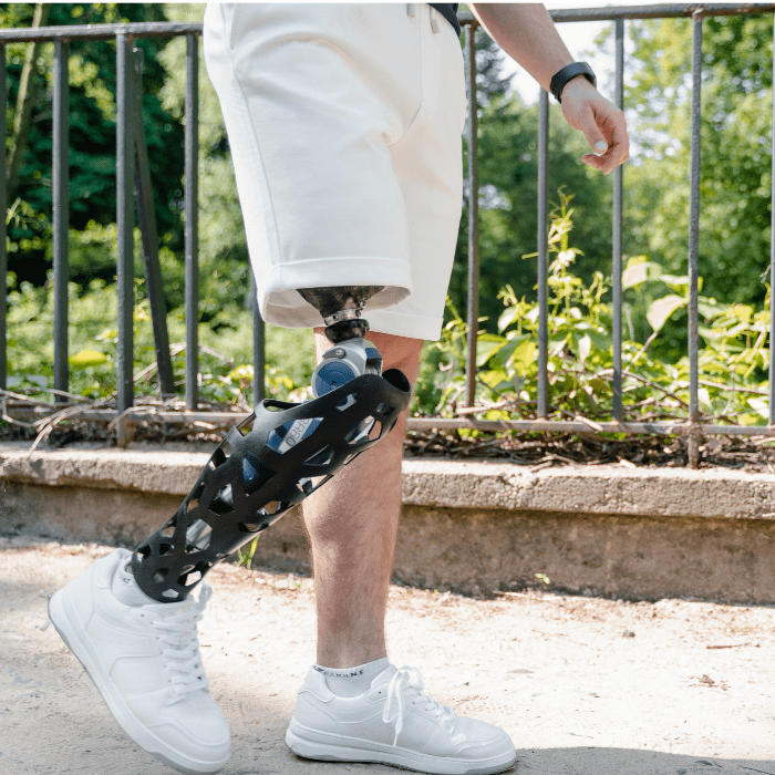 Conoce cómo la inteligencia artificial puede mejorar la caludad de vida de las personas con discapacidad.- Blog Hola Telcel