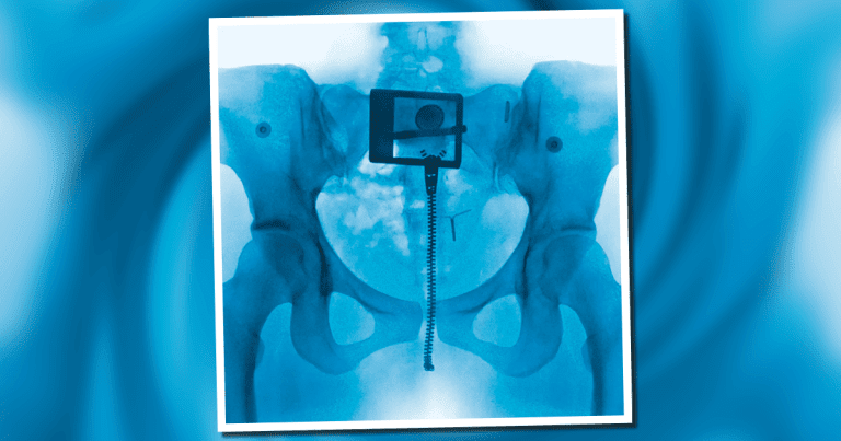 Lorde se reinventa con 'Virgin', su nuevo álbum.- Blog Hola Telcel